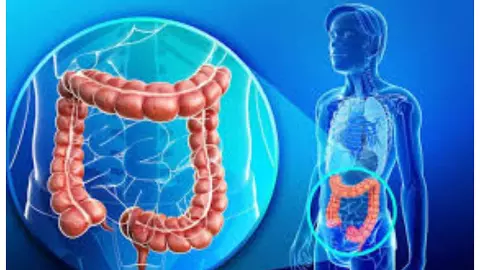 Healthy Intestines