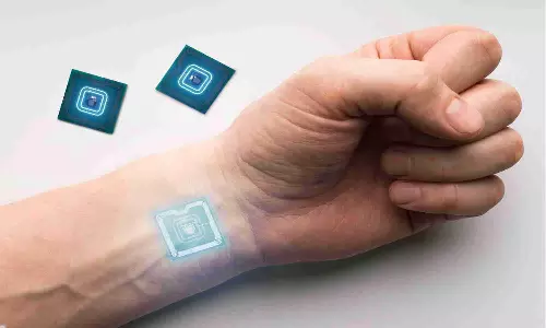 bioelectronic implants charger