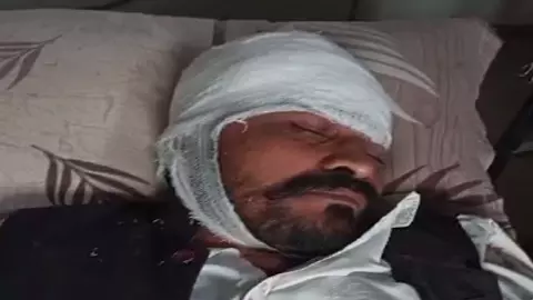The bullies opened fire on the former councilor, when he missed, he attacked his head with a heavy object