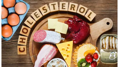High Cholesterol High Cholesterol