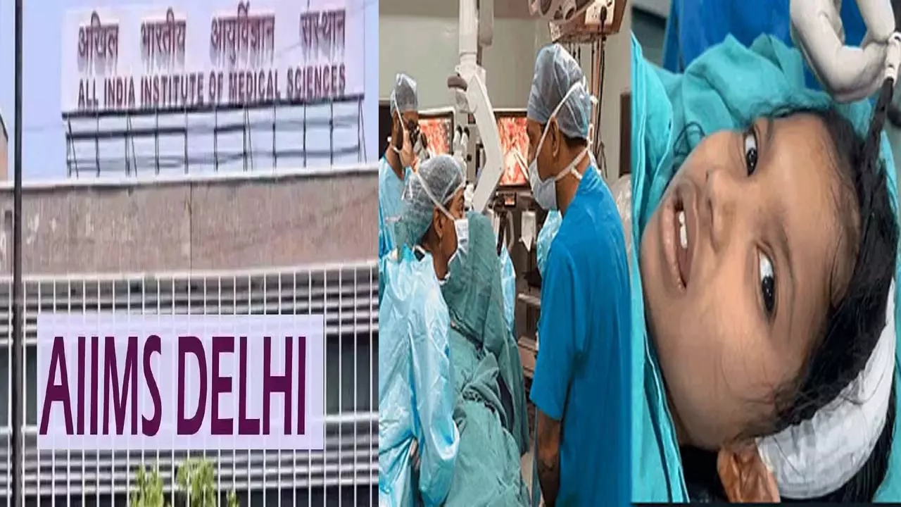 AIIMS doctors, for the first time, removed tumor from the head of a five-year-old girl without unconscious brain surgery