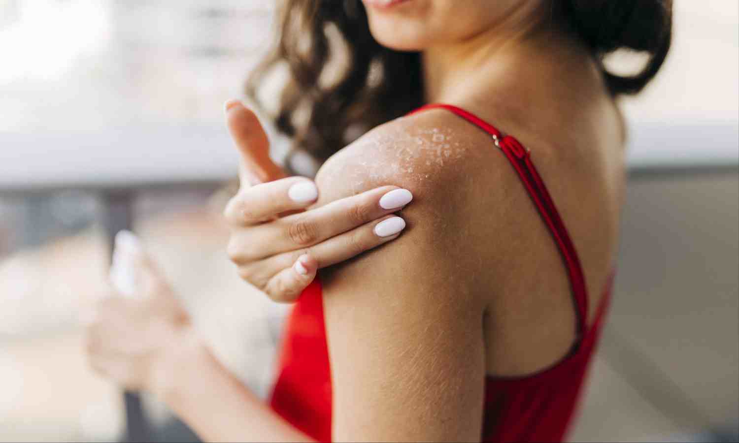 Dry Skin in Winter: सर्दी में अगर हैं ड्राई स्किन से परेशान, तो आजमाएं ये 5 घरेलू नुस्खे, त्वचा बनेगी मुलायम