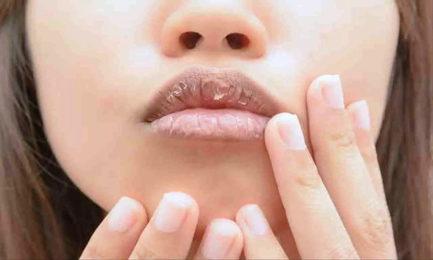 Lip Care Tips: ठंड में फटे होंठों से हैं परेशान तो इन उपायों से होठ बनेंगे मुलायम
