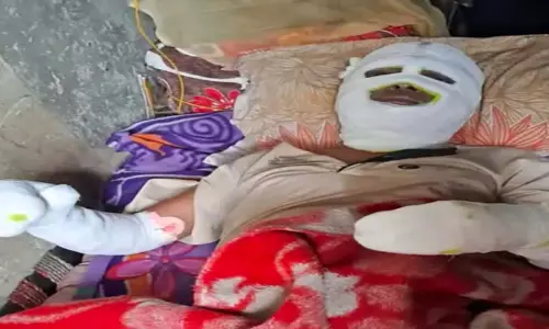 Home guard burnt to death in fire in Meerut, 9 burnt while trying to extinguish the fire