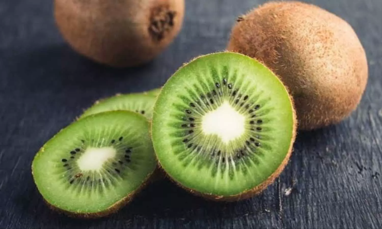 Kiwi Benefits: कीवी खाने के हैं अनगिनत फायदें, जरूर करें डाइट में शामिल