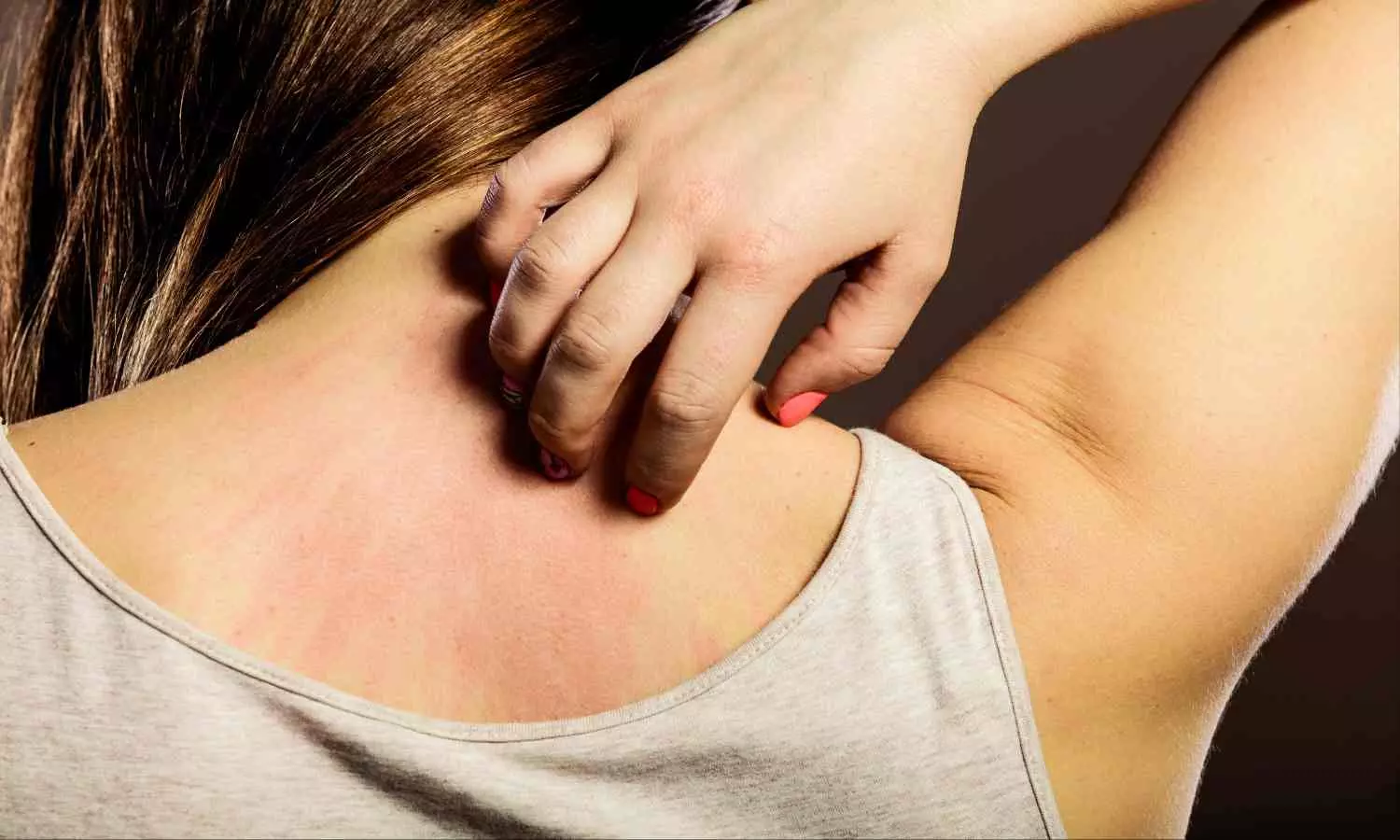Skin Rashes: इन 4 कारणों से होते हैं स्किन रैशेज और चकते, छुटकारा पाने के लिए आजमाएं ये उपाय