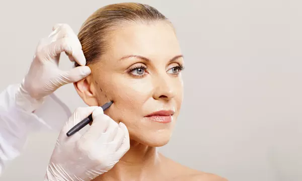 Dermal Fillers 