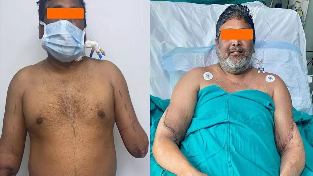 12 hours surgery, team of 20 doctors, brain dead woman put the man in his hands, gave him a new life