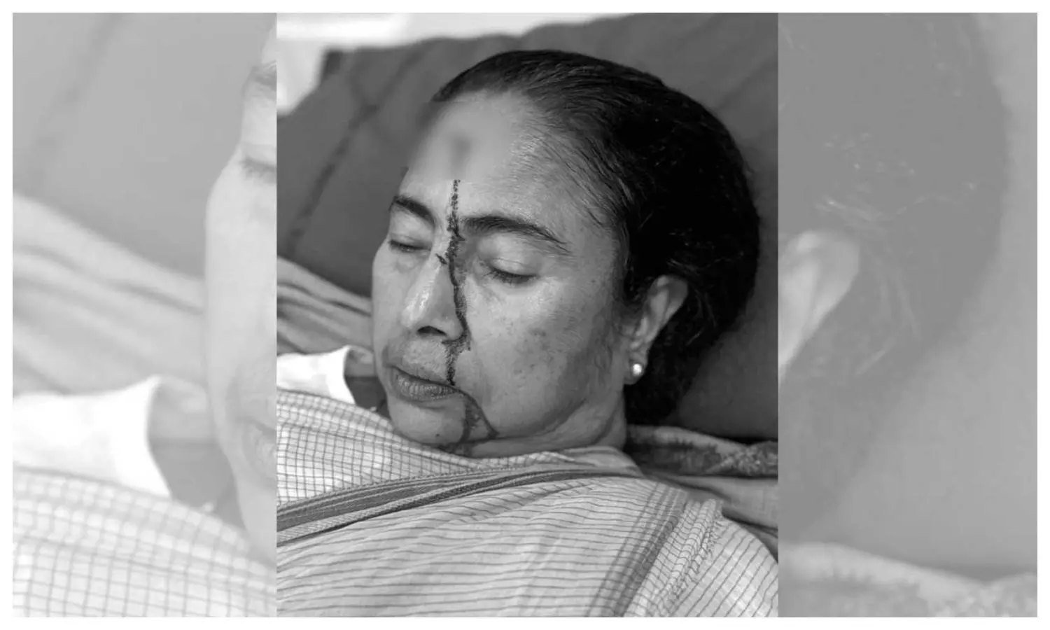 Mamata Banerjee Injured, Newstrack Hindi News