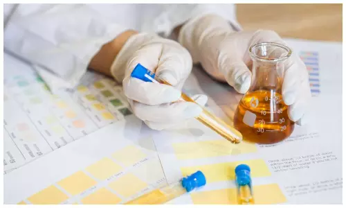 Urine Color Symptoms :