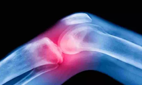Coronavirus infected people Bones melting