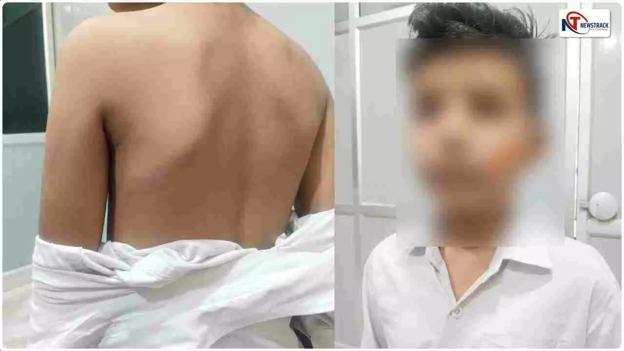 Kanpur News: टेस्ट में नंबर कम आने पर टीचर ने छात्र को बेरहमी से पीटा, डंडे से पिटाई के पड़ गए निशान