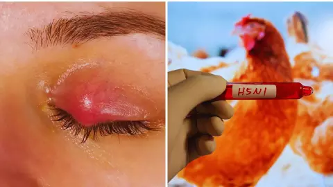 First Human Death From Bird Flu First Human Death From Bird Flu