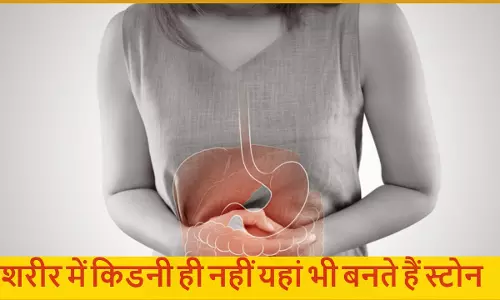Health Special : पित्ताशय और किडनी ही नहीं, यहां भी शरीर में बनते हैं स्टोन, इनसे कैसे बचा जाए?