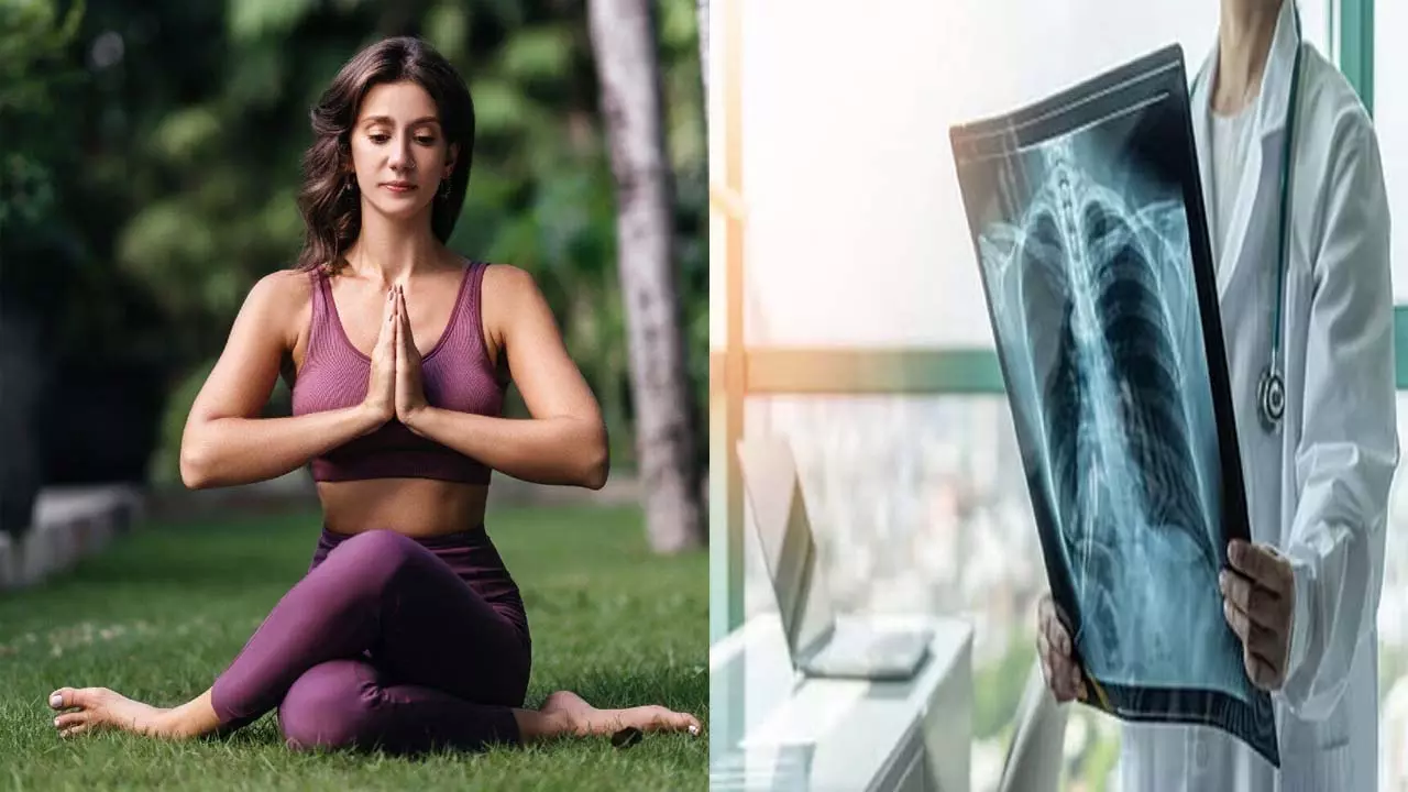 International Yoga Day, Yoga is also a medicine for TB patients