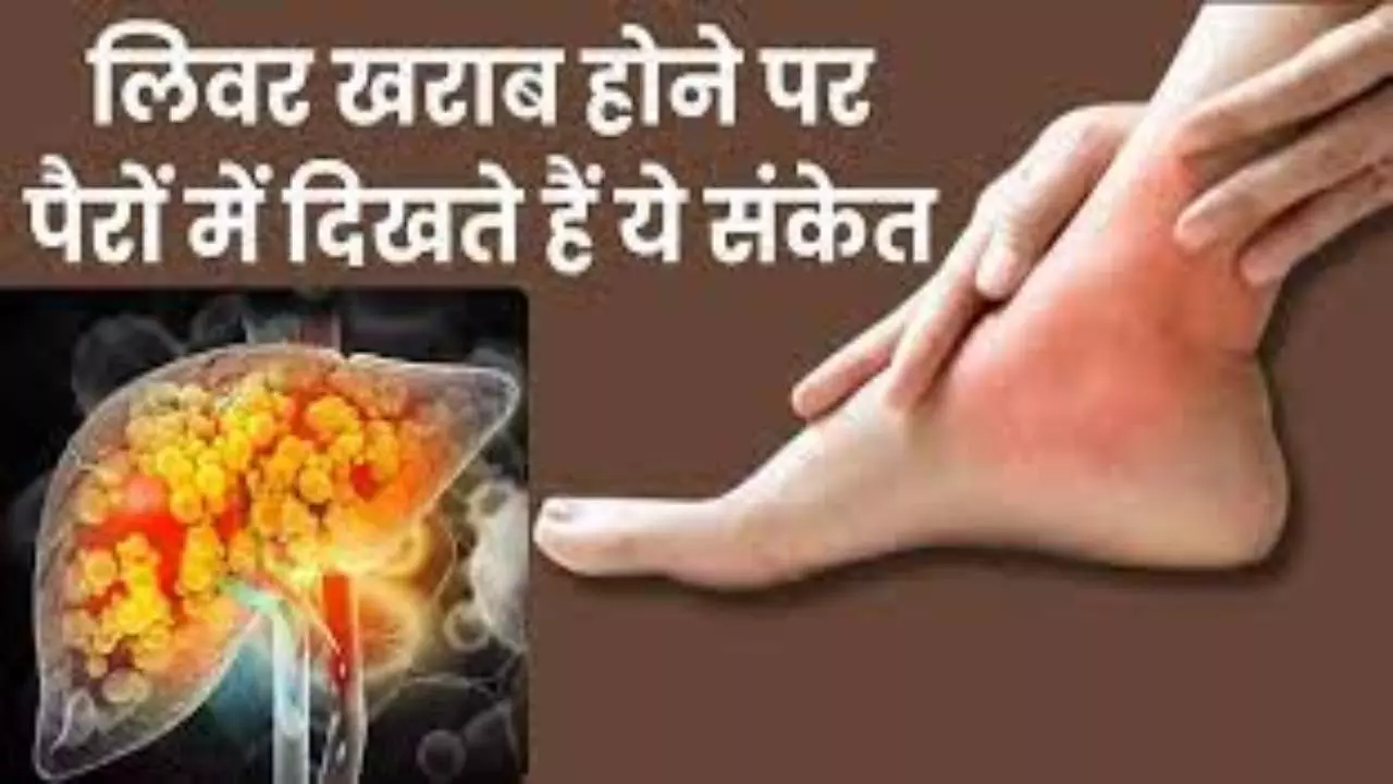 Liver Damage Symptoms In Feet