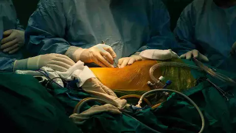 Kidney scandal