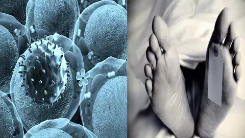 Four children died of Chandipura virus in Gujarat Four children died of Chandipura virus in Gujarat
