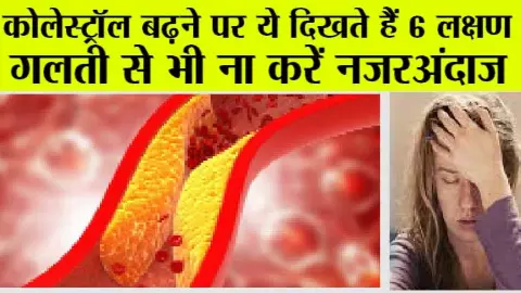 Symptoms Of High Cholesterol Level