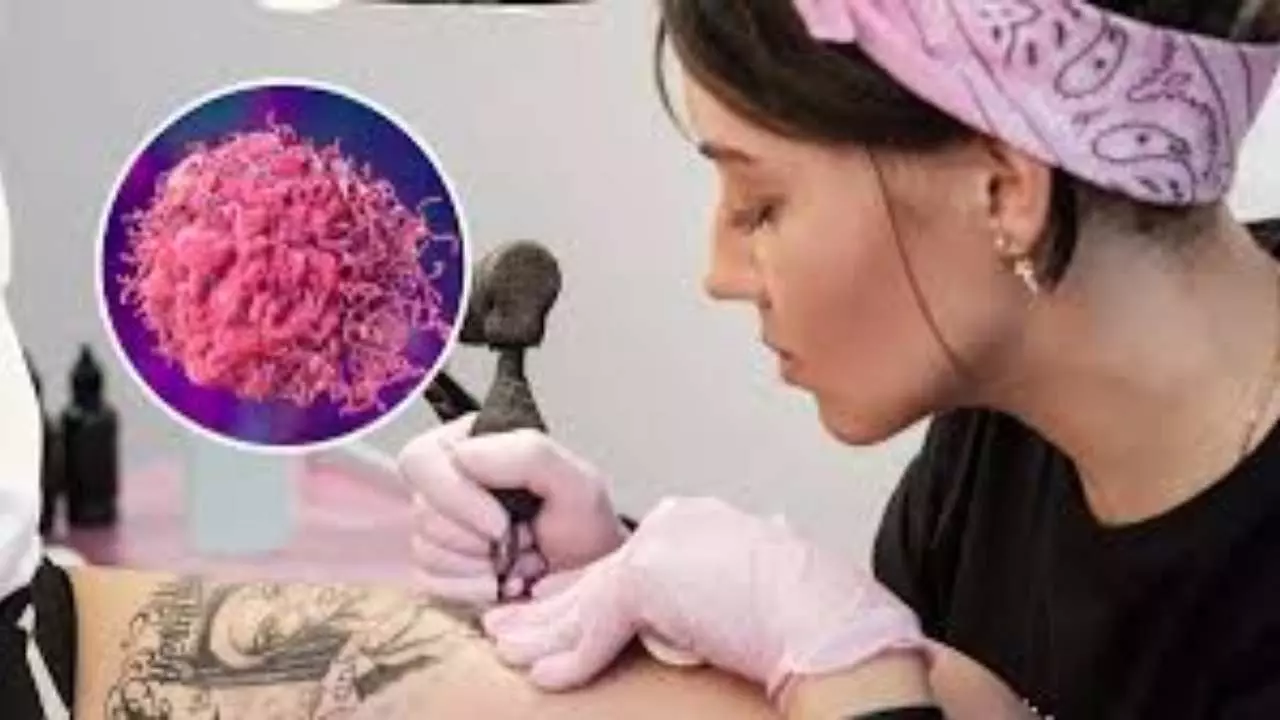 Tattoos Cause Cancer