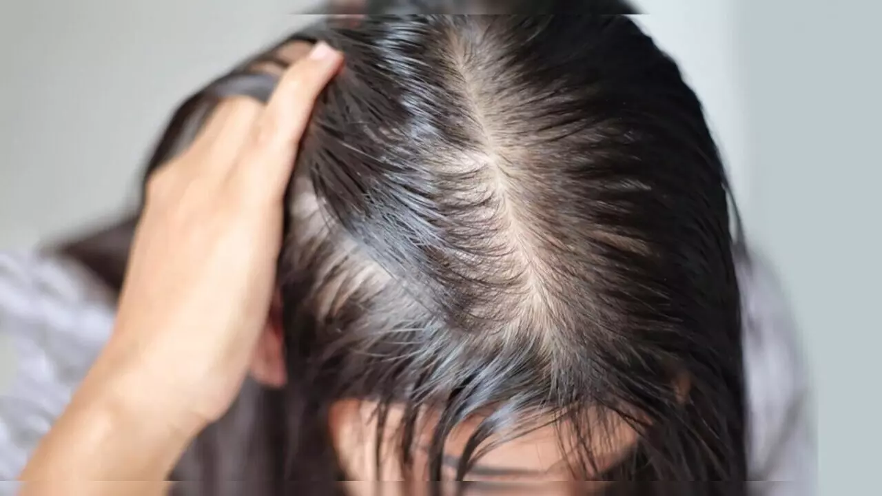 Hair Regrowth Naturally Tips: गंजा होने से बचाएंगे ये घरेलू नुस्खे, सिर में लाते हैं नए बाल