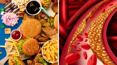 Cholesterol Ko Kaise Kam Kare: इन चीजों को हटा दें डाइट से, कंट्रोल में रहेगा कोलेस्ट्रॉल Cholesterol Ko Kaise Kam Kare: इन चीजों को हटा दें डाइट से, कंट्रोल में रहेगा कोलेस्ट्रॉल
