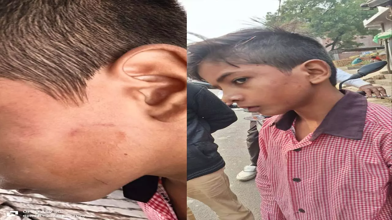 Primary school teacher beats student brazenly at Lonikatra area police station