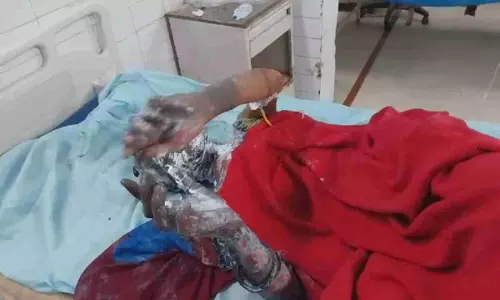 Bahraich News: अलाव ताप रही महिला हुई हादसे का शिकार, लखनऊ रेफर