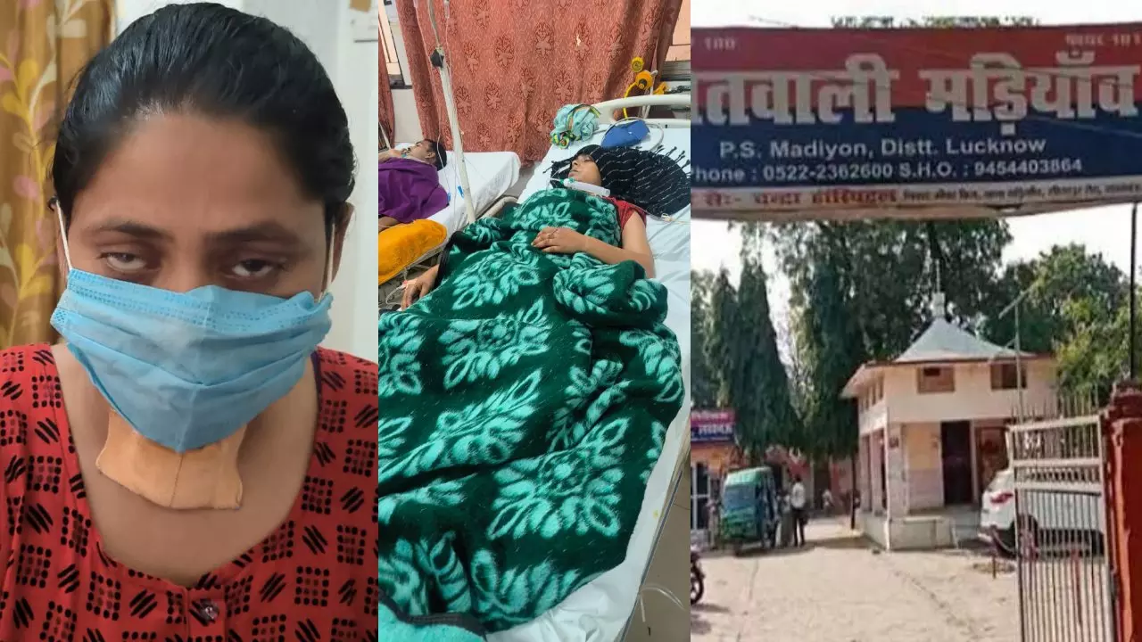 lucknow police show humanity save life of girl injured from attack in madiyaon