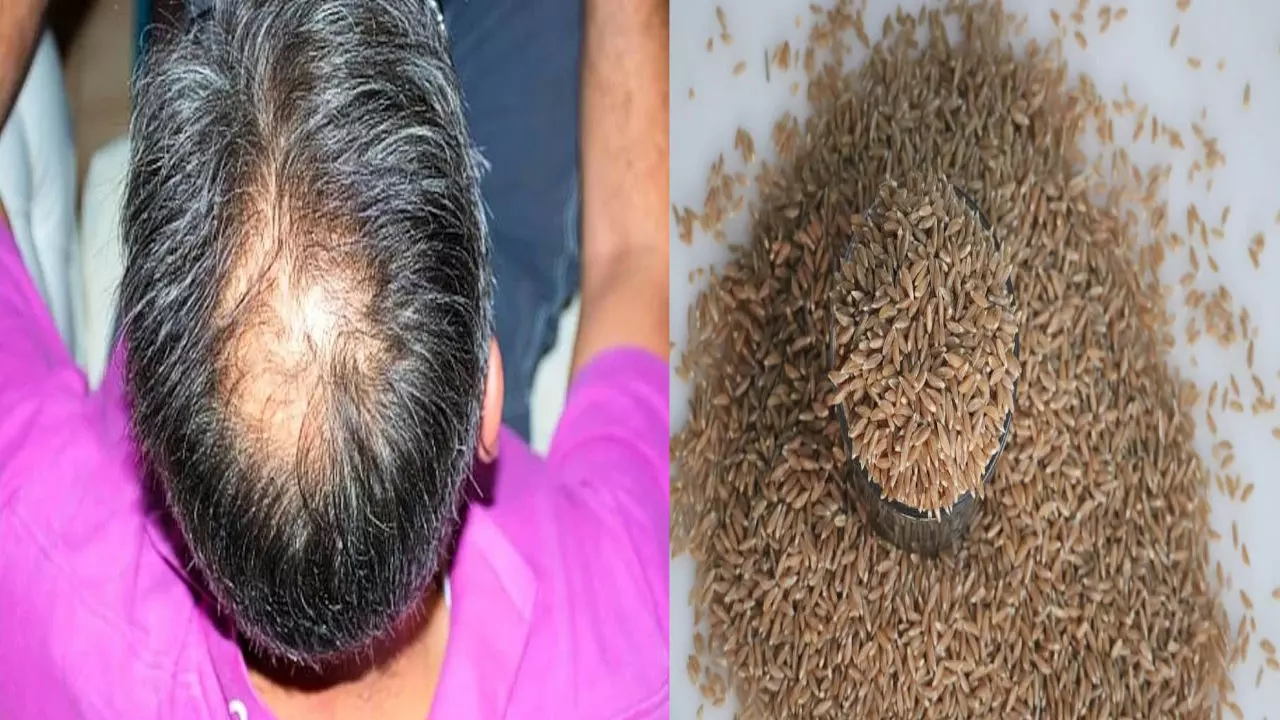 Buldhana hair loss cases