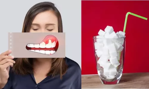 Oral Cancer: शुगरी ड्रिंक्स से बढ़ सकता है ओरल कैंसर का रिस्क, नई स्टडी में हुआ चौंकाने वाला खुलासा, जानें क्या होता है मुंह का कैंसर