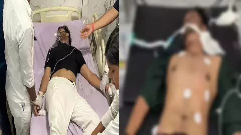5 students burnt due to lightning, admitted in ICU