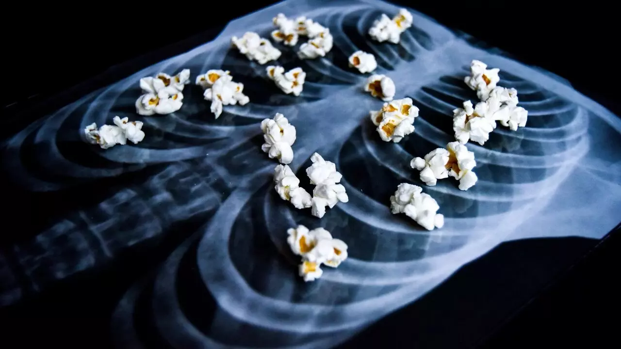 Popcorn Lungs: अमेरिकी किशोरी को वेपिंग से हुई पॉपकॉर्न लंग्स की बीमारी, जानें क्या है ये रोग और किसे-किसे हो सकता है