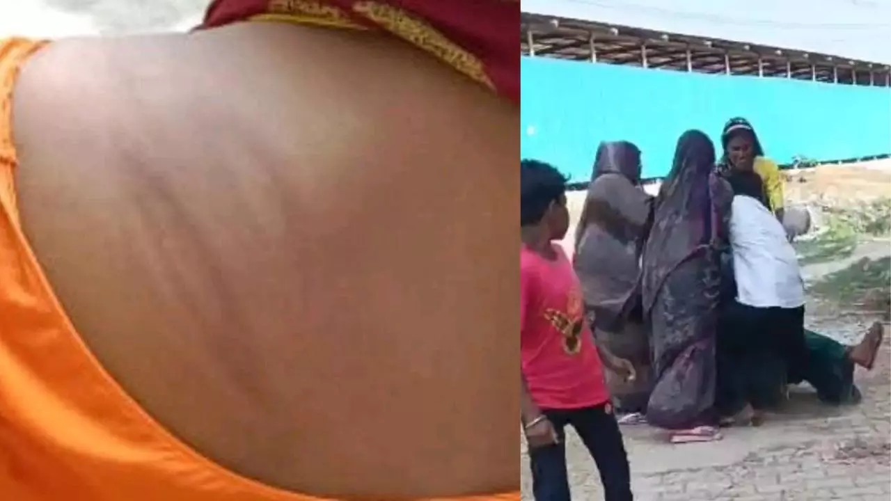 Mainpuri News: शराब के नशे में दबंगों ने महिलाओं से की मारपीट, पीड़िता ने की शिकायत