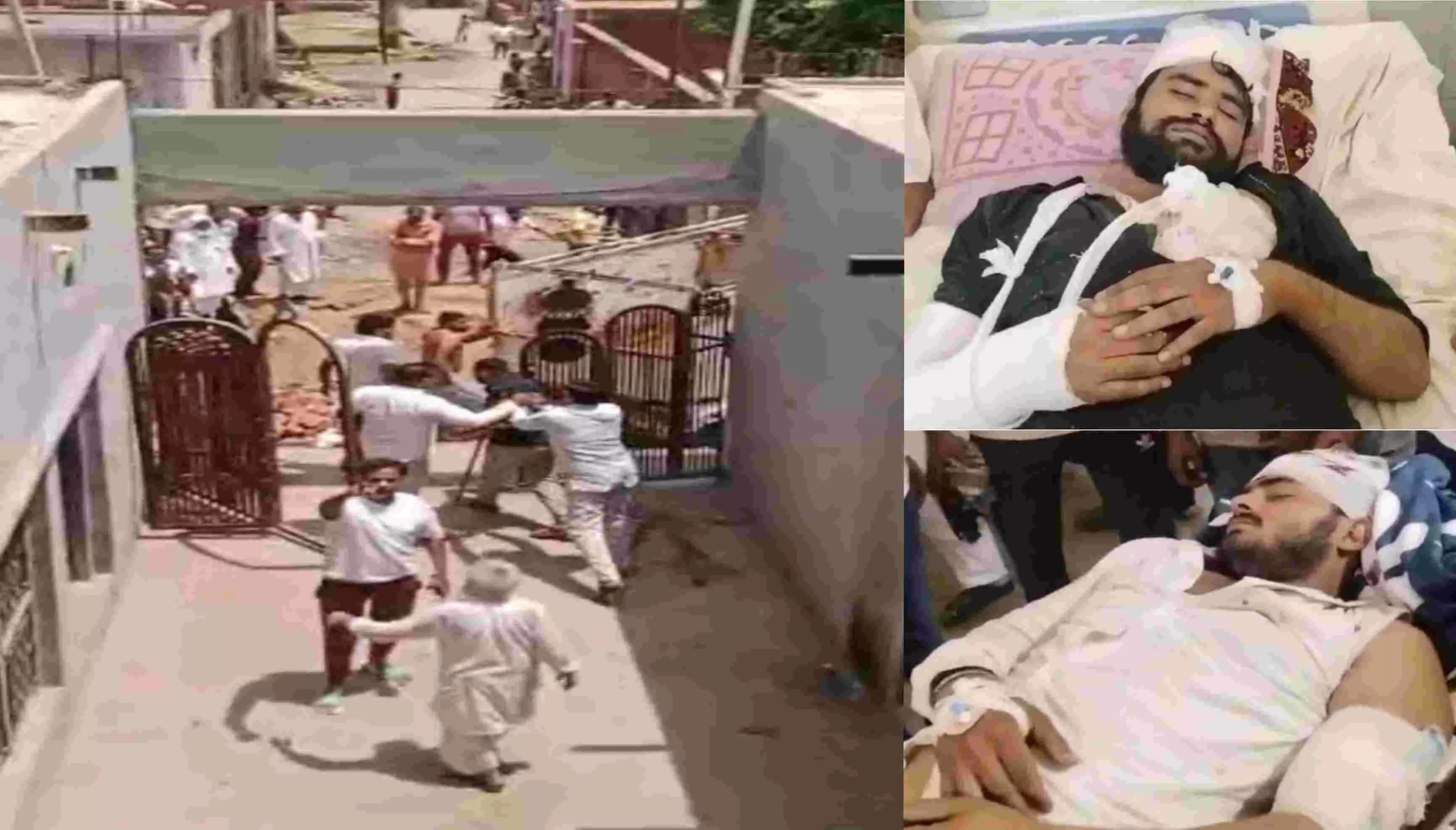 Bulandshahr News: ककोड़ में रंजिशन मारपीट- पथराव-फायरिंग, 3 घायल, वीडियो वायरल, 15 पर FIR, आरोपी फरार