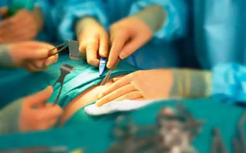 गुरुग्राम के डॉक्टर्स के छूटे पसीने, बुजुर्ग के पेट से निकले इतने पत्थर, सिर्फ गिनने में लग गए 6 घंटे!