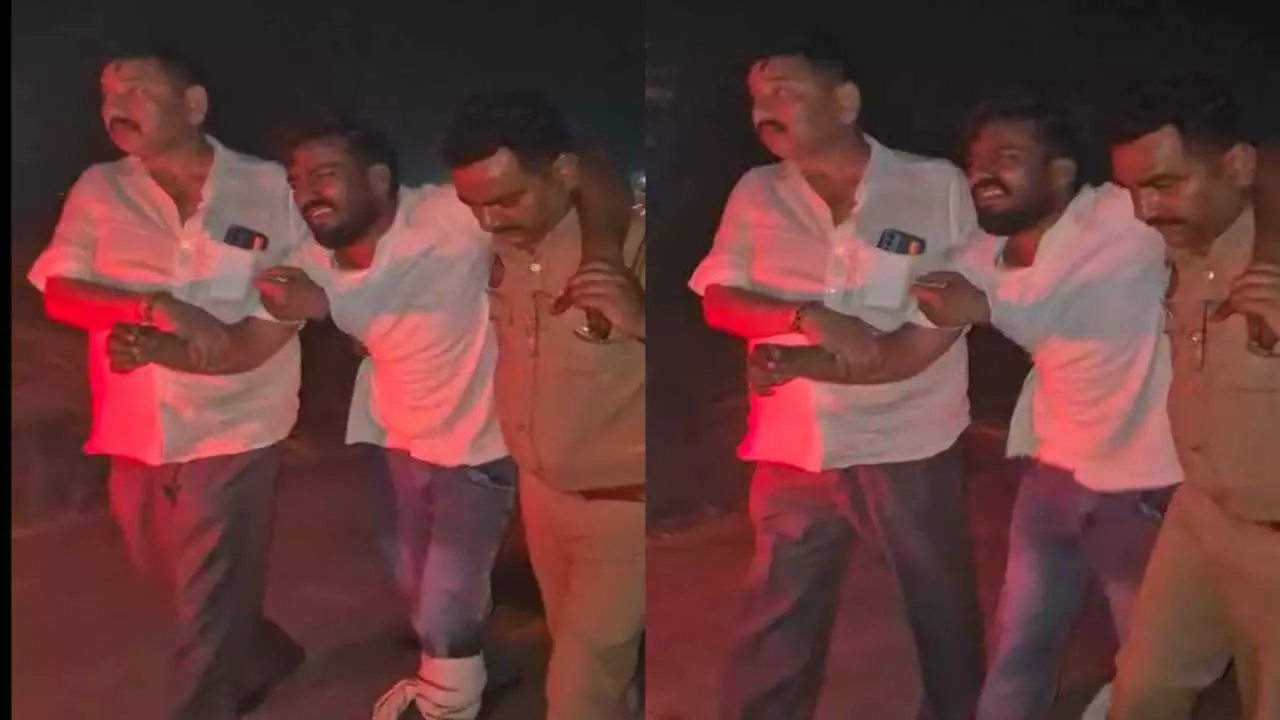 Unnao News: उन्नाव में पुलिस मुठभेड़, एक लुटेरे के पैर मे लगी गोली, 19 मई को हुई थी लूट