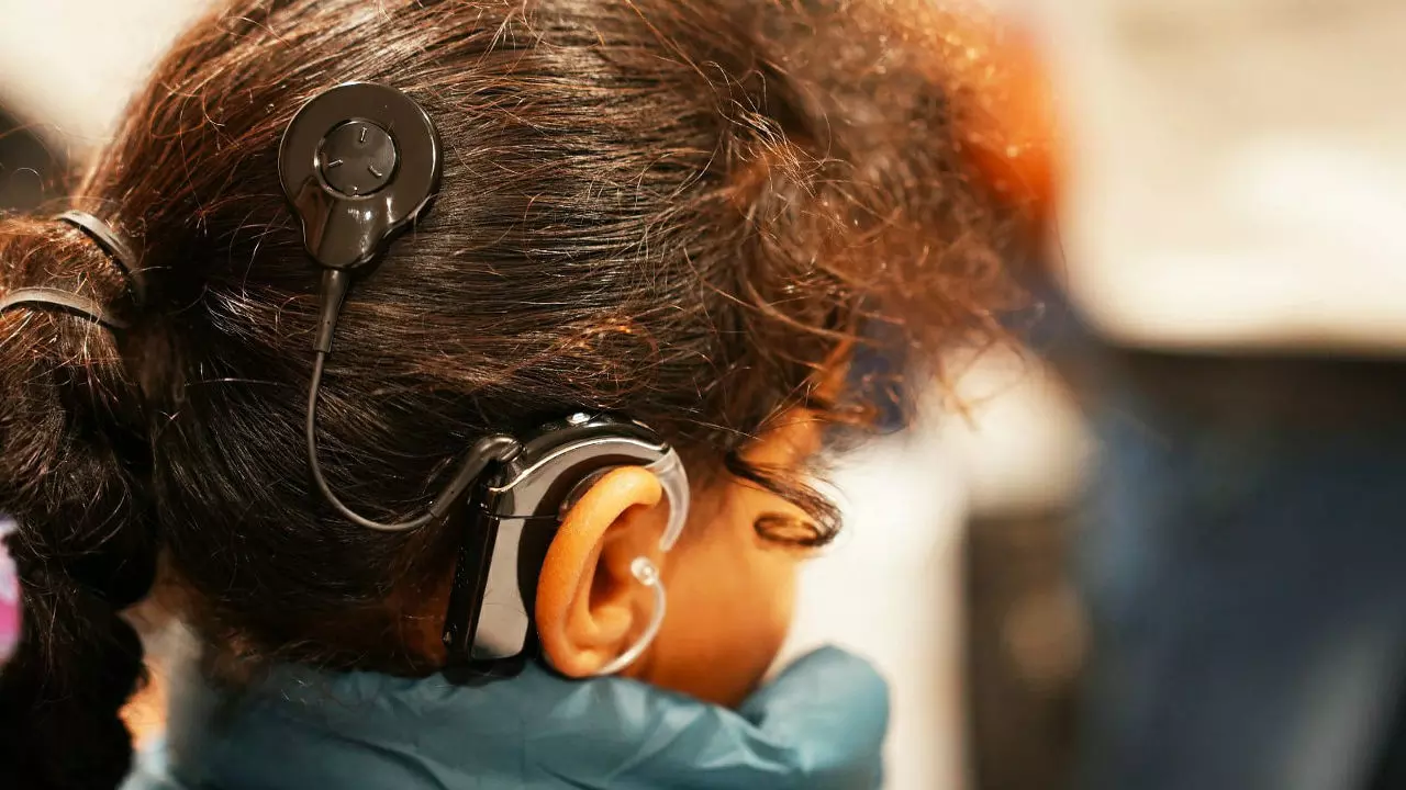 cochlear implant surgery