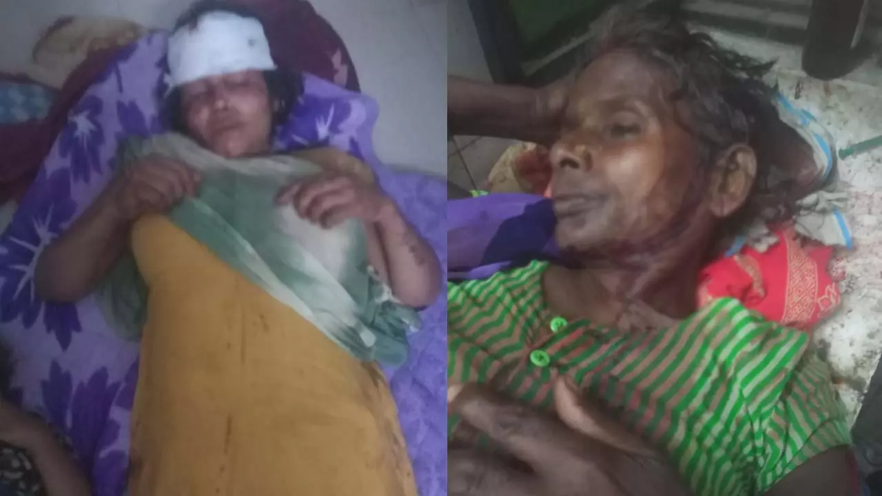 injured, four in critical condition in Sage brothers in land dispute
