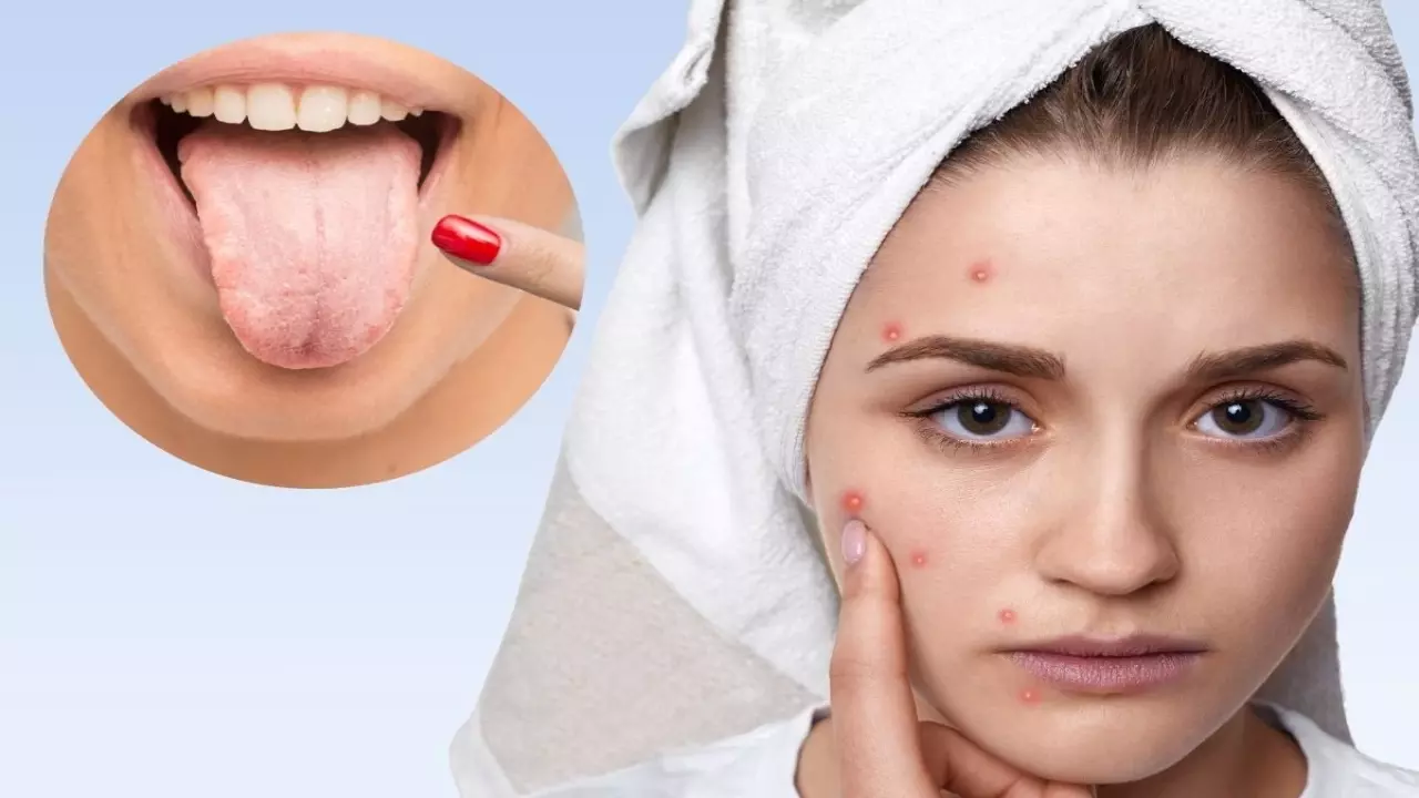 morning saliva for dark circles myth or fact