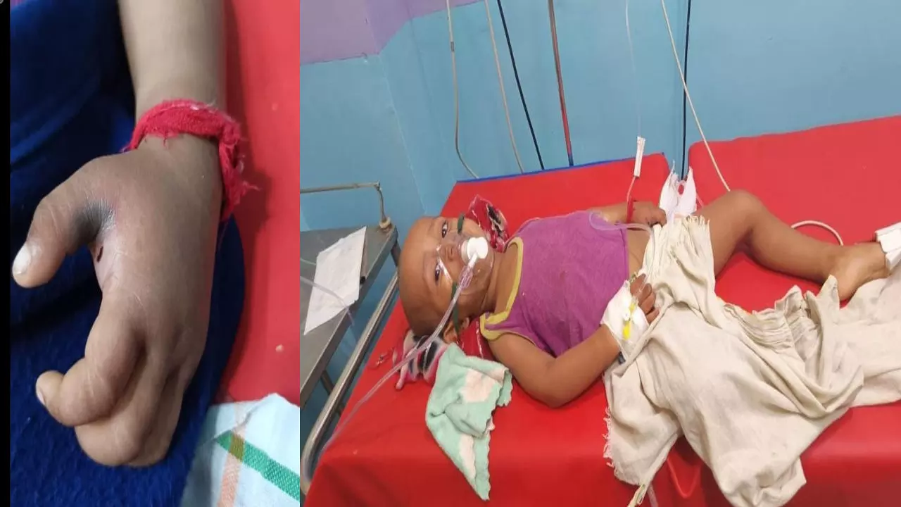 Etawah News: डेढ़ साल के मासूम को नागिन ने डसा, स्नेक हेल्पलाइन से समय पर इलाज मिला, बच गई जान!