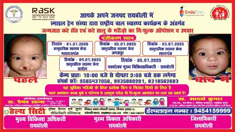 Raebareli News: कटे होंठ और तालू के बच्चों के लिए आशा की किरण, निःशुल्क उपचार शिविर