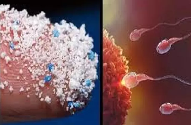 Microplastics Reached Sperm and Ovaries