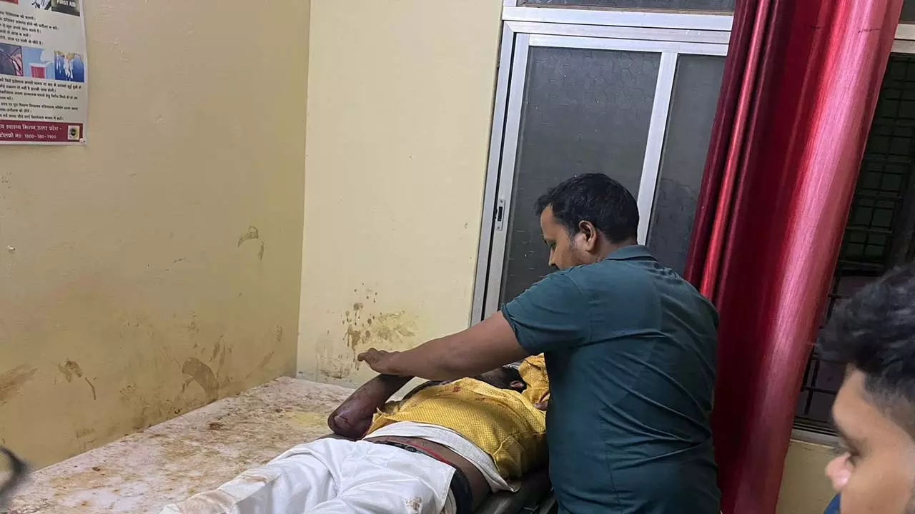 youth critically injured when bike Slip Road Accident News in hindi