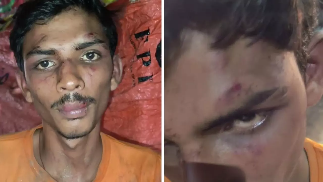 Lucknow News: लखनऊ में दबंगों का आतंक! असलहे की नोक पर युवक को अगवा कर कार में की गई बेरहमी से पिटाई, जांच में जुटी पुलिस