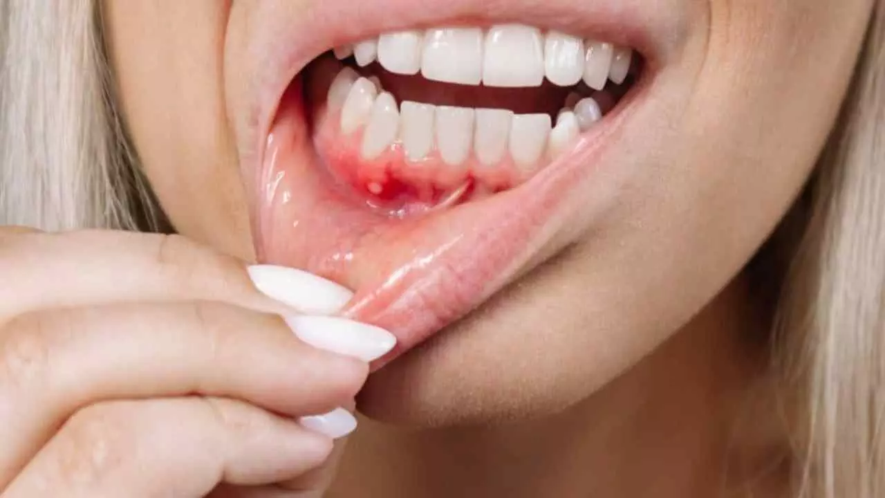 Bad Dental Health