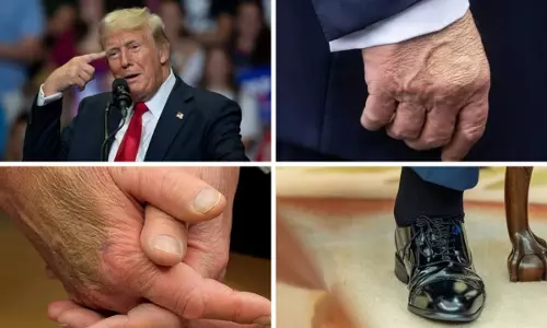 Donald Trump health
