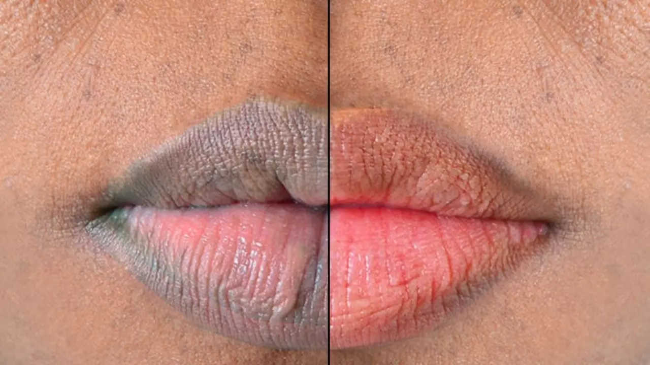 Home Remedies For Pink Lips