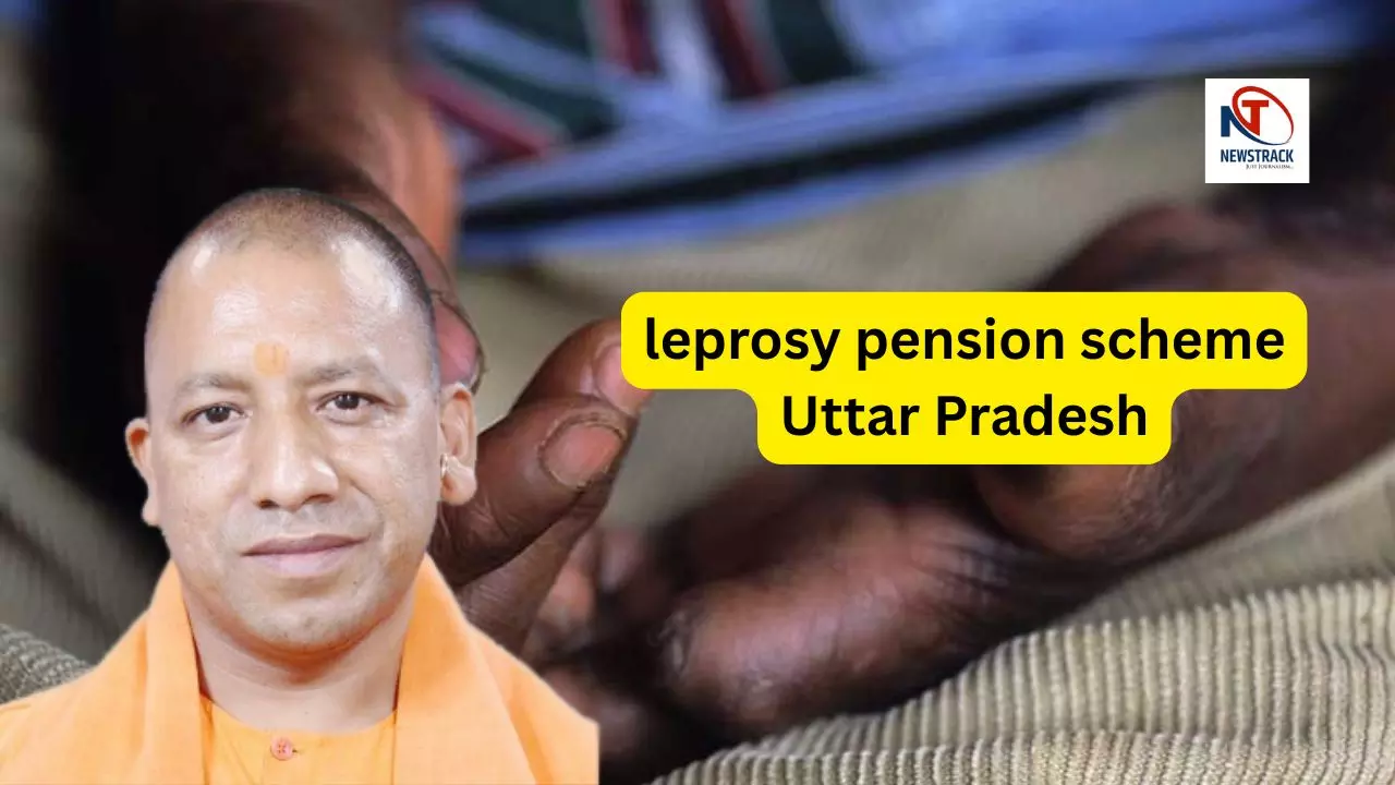 Leprosy pension scheme Uttar Pradesh
