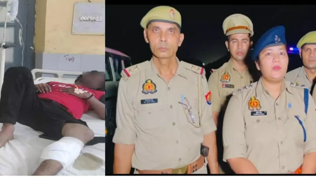 Bulandshahr News:: खुर्जा में मुठभेड़, मोबाइल लुटेरा जुनैद हुआ लंगडा